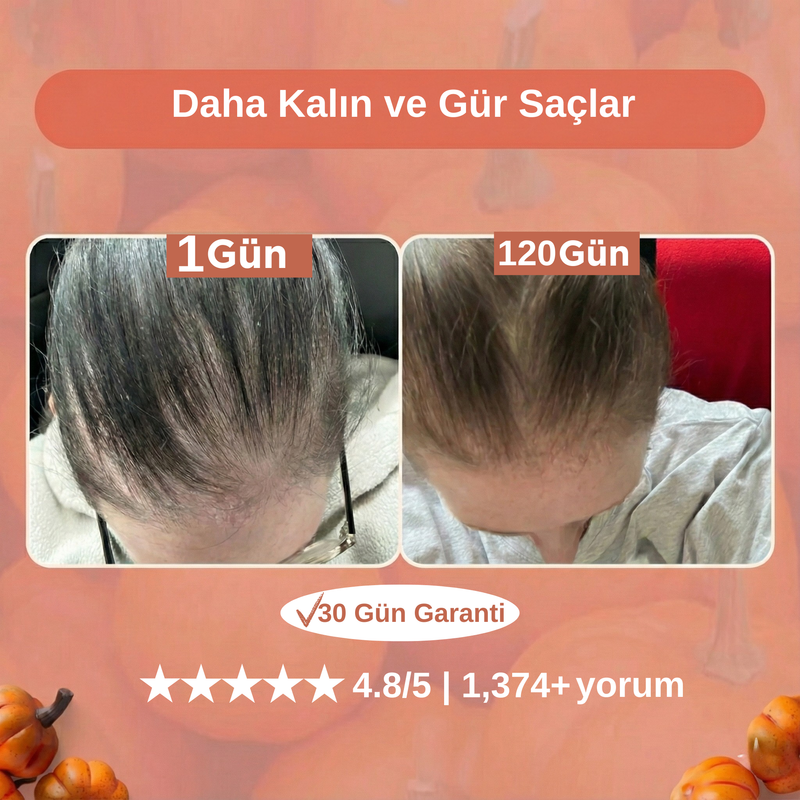 Balera Ürün